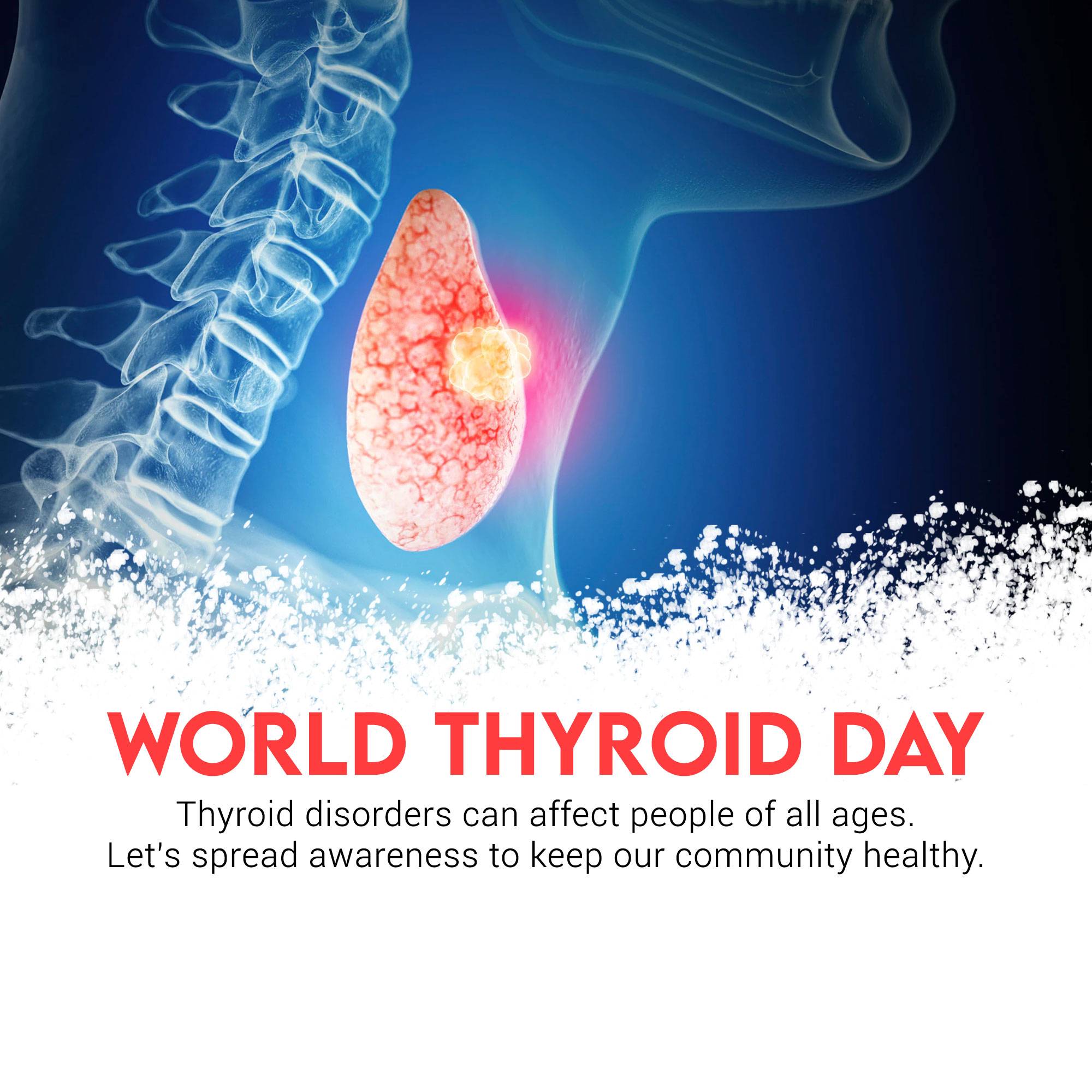 World Thyroid Awareness Day